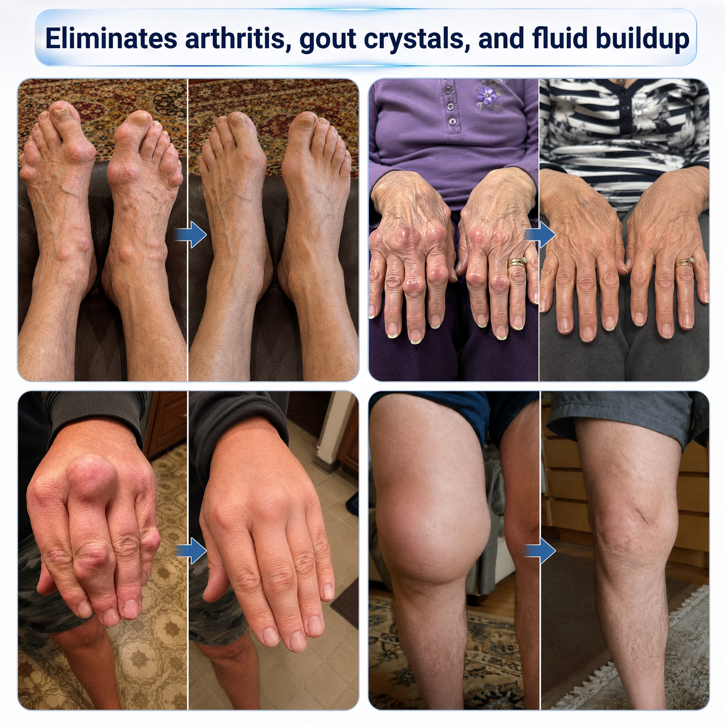𝗜𝐅𝙈𝗔𝑮𝗜𝐂® 💠 𝐌𝐢𝐜𝐫𝗼𝗻𝗲𝗲𝙙𝙡𝙚 𝗥𝗼𝗹𝗹-𝐎𝐧 𝐉𝐨𝗶𝗻𝘁 & 𝑩𝒐𝒏𝒆 𝗟𝐢𝗾𝙪𝐢𝒅🦴