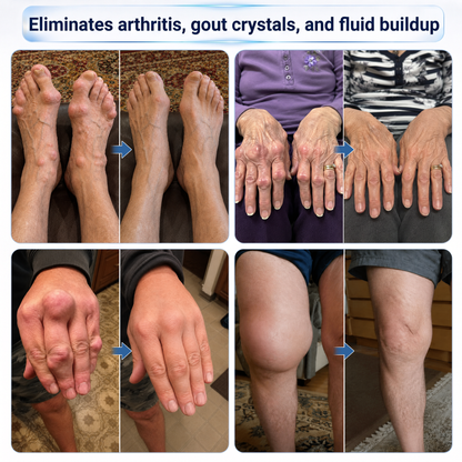 𝗜𝐅𝙈𝗔𝑮𝗜𝐂® 💠 𝐌𝐢𝐜𝐫𝗼𝗻𝗲𝗲𝙙𝙡𝙚 𝗥𝗼𝗹𝗹-𝐎𝐧 𝐉𝐨𝗶𝗻𝘁 & 𝑩𝒐𝒏𝒆 𝗟𝐢𝗾𝙪𝐢𝒅🦴
