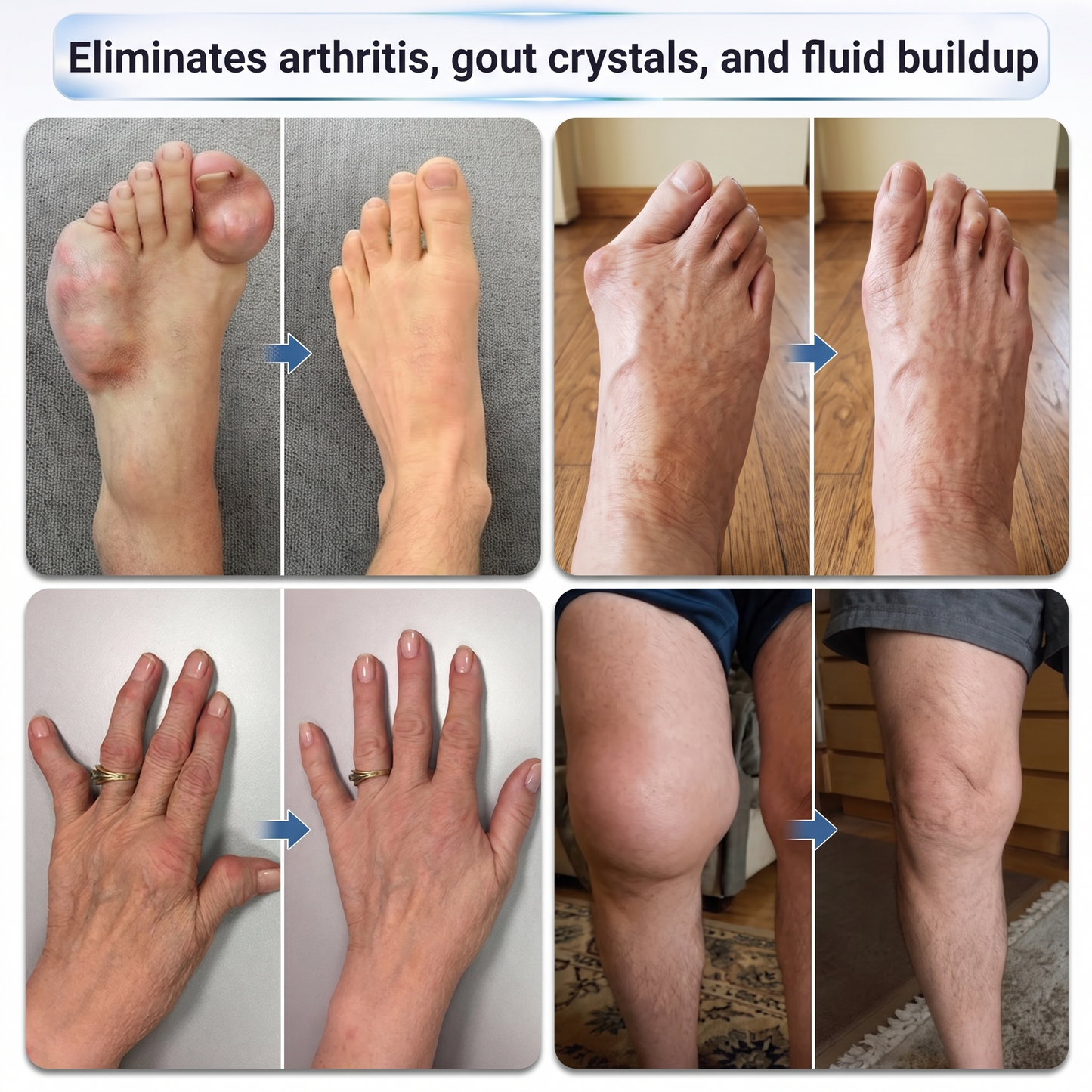 𝗜𝐅𝙈𝗔𝑮𝗜𝐂® 💠 𝟬.𝟬𝟱𝗺𝗺 𝐌𝐢𝐜𝐫𝗼𝗻𝗲𝗲𝙙𝙡𝙚 𝑩𝒐𝒏𝒆 & 𝐉𝐨𝗶𝗻𝘁 𝗥𝗼𝗹𝗹𝒆𝙧🩵