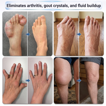 𝗜𝐅𝙈𝗔𝑮𝗜𝐂® 💠 𝟬.𝟬𝟱𝗺𝗺 𝐌𝐢𝐜𝐫𝗼𝗻𝗲𝗲𝙙𝙡𝙚 𝑩𝒐𝒏𝒆 & 𝐉𝐨𝗶𝗻𝘁 𝗥𝗼𝗹𝗹𝒆𝙧🩵