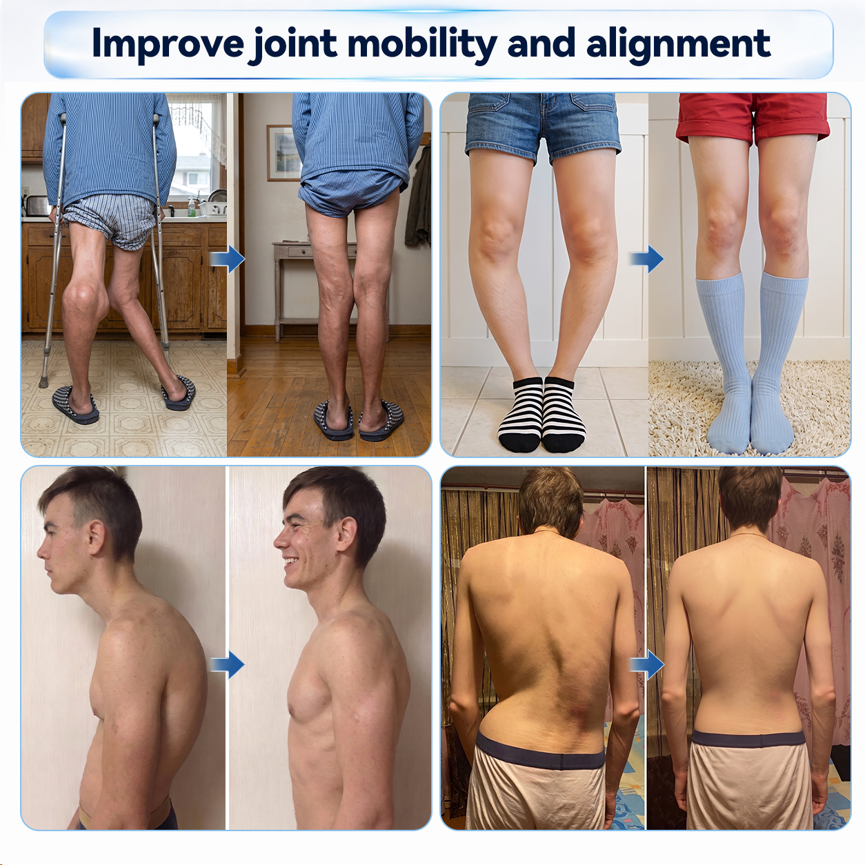 𝗜𝐅𝙈𝗔𝑮𝗜𝐂® 💠 𝟬.𝟬𝟱𝗺𝗺 𝐌𝐢𝐜𝐫𝗼𝗻𝗲𝗲𝙙𝙡𝙚 𝑩𝒐𝒏𝒆 & 𝐉𝐨𝗶𝗻𝘁 𝗥𝗼𝗹𝗹𝒆𝙧🩵
